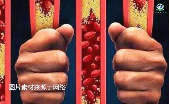 不想給血管&ldquo;添堵&rdquo;，盡量少吃以下這些東西，或許能讓腦梗離遠些  
